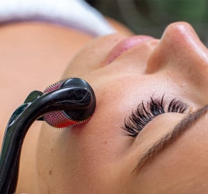 Dermaroller vs Mesotherapie Anwendung